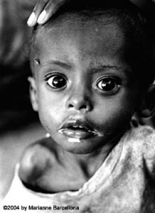 1211252669_starving child